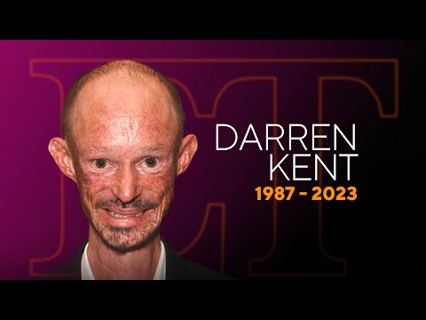 Darren Kent, Game of Thrones Actor, Dead at 36