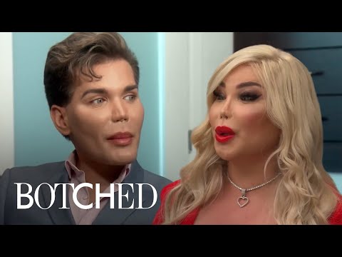 Amazing Transitions on Botched: Rodrigo Alves | Botched | E!