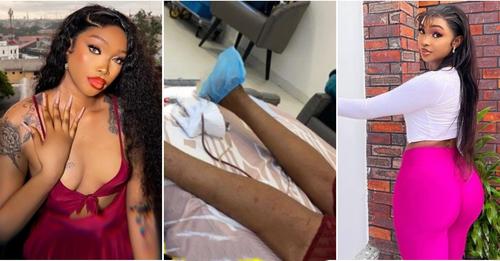 ”This surgeon wants to kill me” – Popular Transgender Cries For Help After Failed Surgery