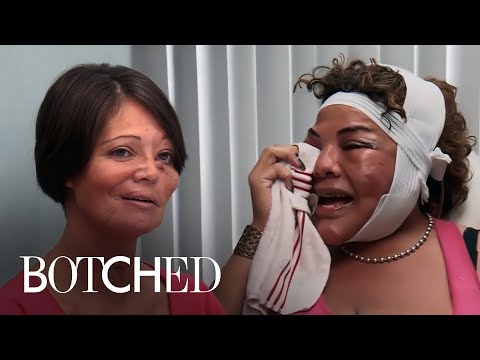 5 Touching & Emotional Patient Stories on “Botched” | Botched | E!