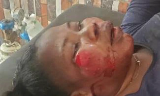 Nigerian Woman Fights For Life After Being Brutalised, Hit With Heavy Stone By Ex-Husband For Putting Marks On Children’s Heads In Lagos