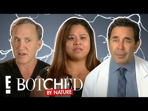 The Lightning Strike Survivor’s SHOCKING TRANSFORMATION | Botched By Nature | E!