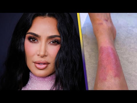 Kim Kardashian Shows Her ‘PAINFUL’ Psoriasis Rash