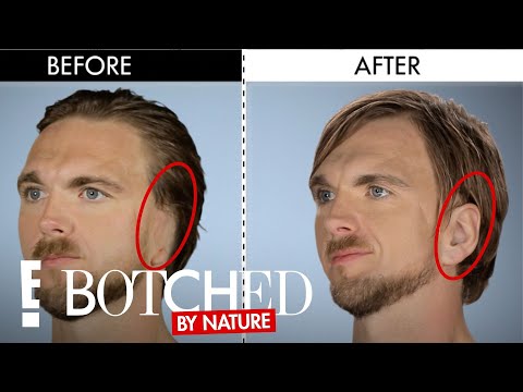 The Modern Day Van Gogh | Botched By Nature | E!