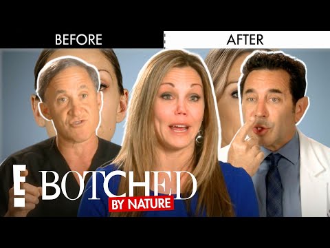 Nicole’s COLLAPSED Nose FULL TRANSFORMATION | E! Entertainment