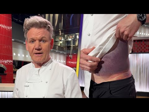 Gordon Ramsay Feels ‘Lucky’ After Bike Crash Leaves Him Badly BRUISED