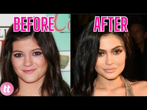 Kylie Jenner Is Allegedly Obsessed With Plastic Surgery