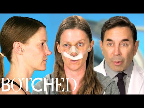 Santa Broke Sara’s Nose! Dr. Nassif’s Ultimate ‘Christmas in July’ Transformation | Botched | E!