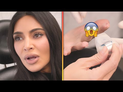 Kim Kardashian Shares GRUESOME Finger-Slicing Accident