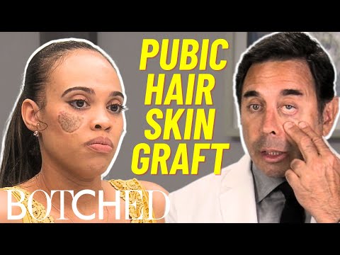 Dog Attack Survivor Left with Pubic Hair Growing on Her Face FULL TRANSFORMATION | Botched | E!