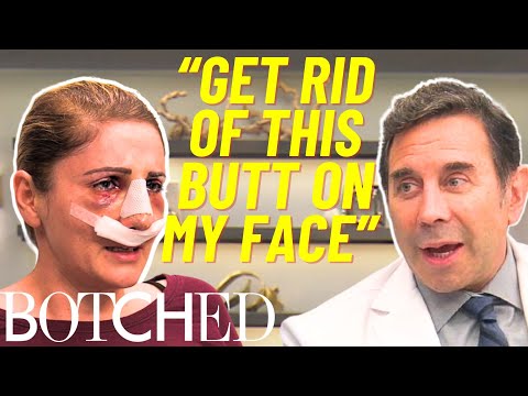 Dr. Nassif Attempts To Fix Rose’s ‘Butt Nose’ After Two Failed Surgeries | Botched | E!