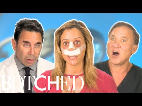 Dr. Nassif Transforms Norina’s “Ski Lift” Nose FULL TRANSFORMATION | Botched | E!